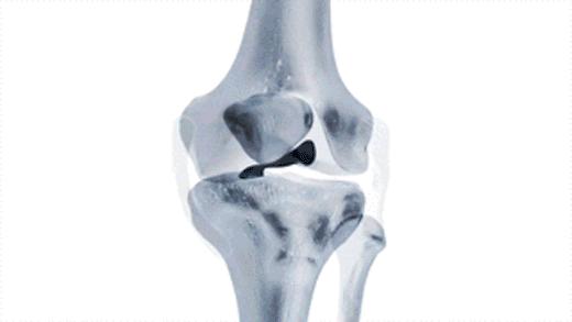 到底是手术好还是保守治疗好,保守治疗和手术治疗怎么选