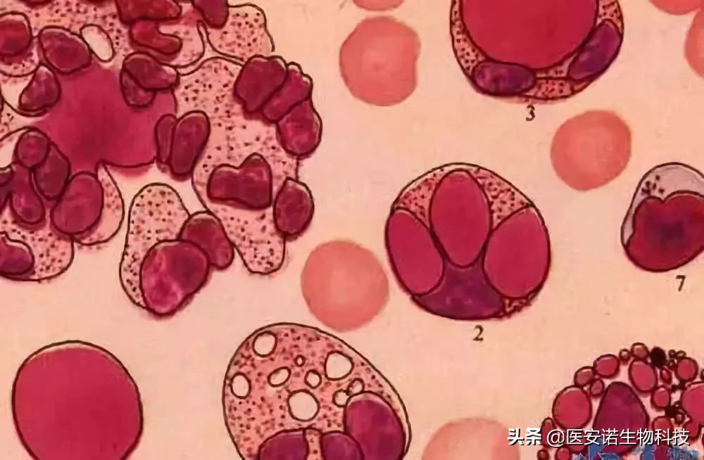 间充质干细胞治疗糖尿病效果如何,间充质干细胞能治疗糖尿病吗