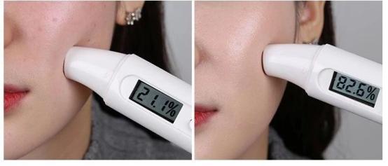 国际上有根除遗传雀斑的方法吗,专业祛斑四天根除遗传性雀斑