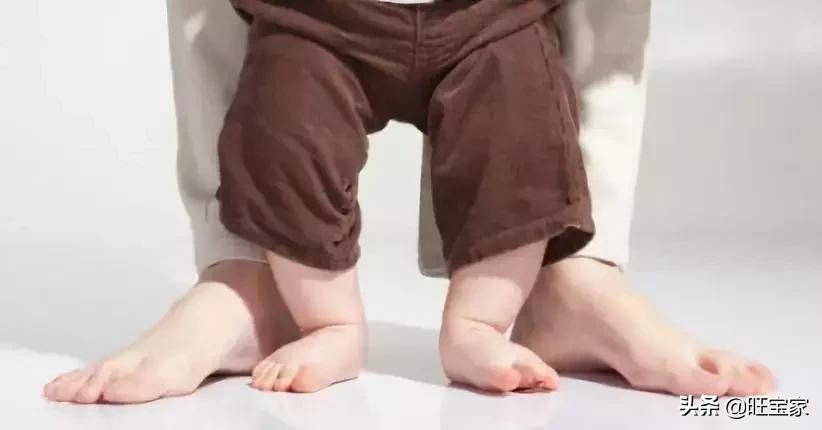 林允儿的o型腿,林允儿的o型腿走路