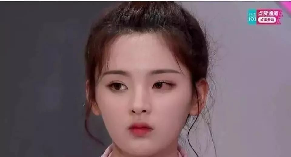 美瞳角膜损伤,美瞳选的不对会导致角膜受损吗