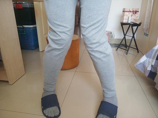 X形腿咋矫正,导致x型腿的原因