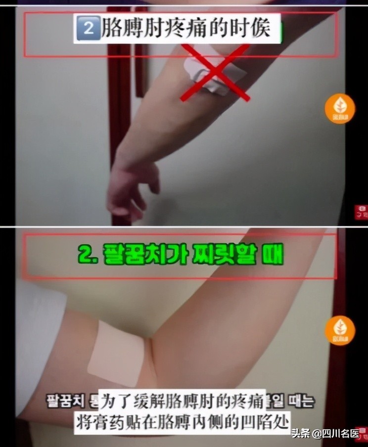 哪儿疼贴哪儿,膏药是不是哪儿疼贴哪儿