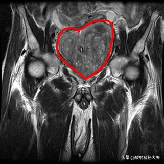 放射科趣味图片,放射科亮点图片