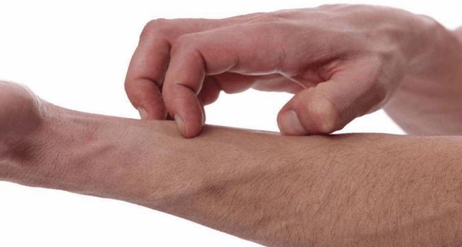 医生有阴虱是怎么回事,男性下身有虫子不治可以吗