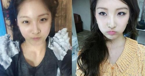 脸部微整形的危害,脸部微整形有什么危害