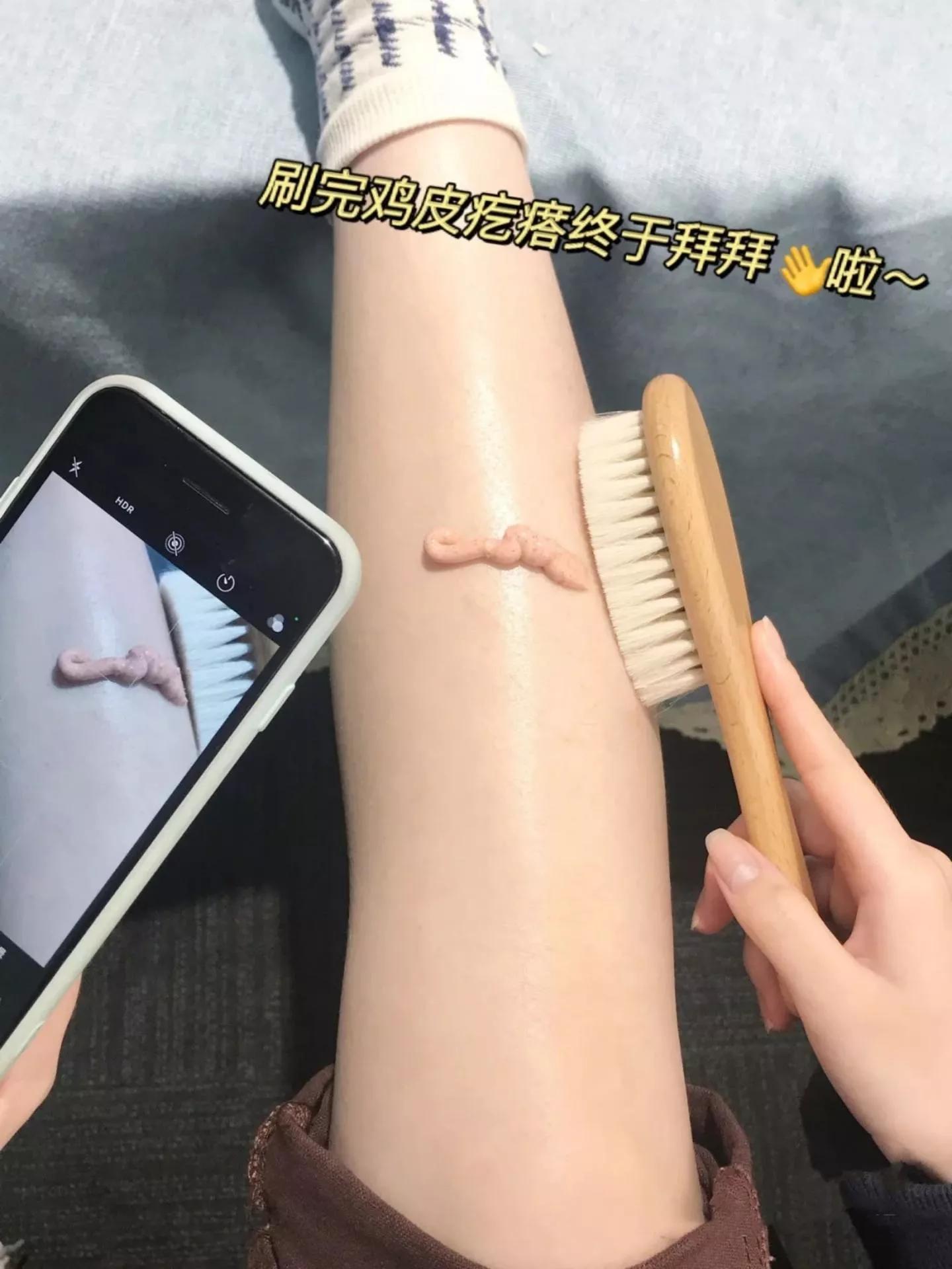 去腿上鸡皮方法,怎么去鸡皮肤简单方法