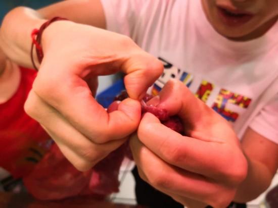 市场上有寄生虫的牛肉,新鲜牛肉里面会不会有寄生虫