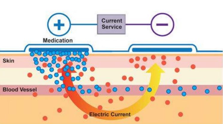 雅萌到底该怎么选,雅萌顶配值得入手吗