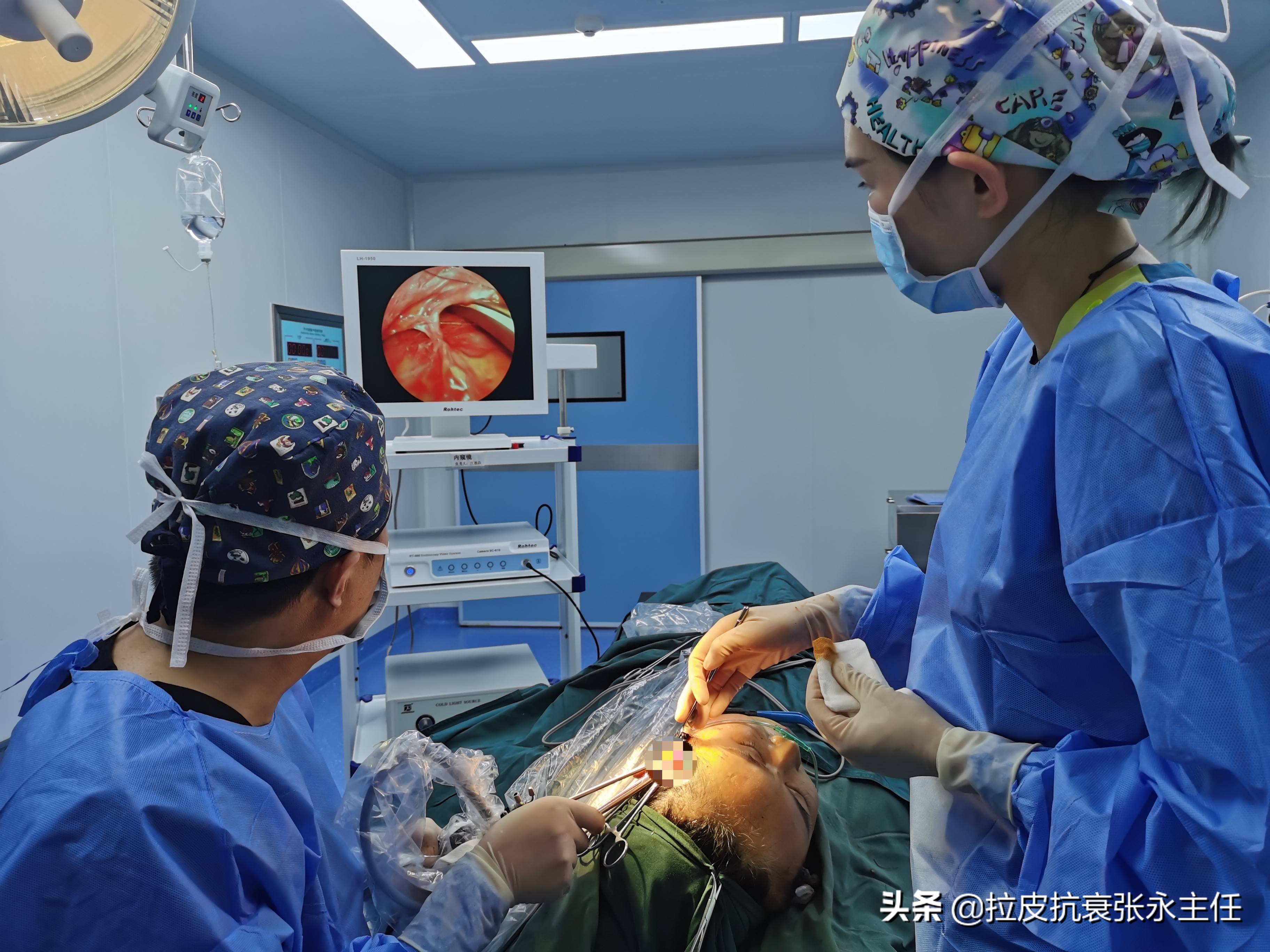 内窥镜除皱和小切口除皱,内窥镜除皱术真实案例