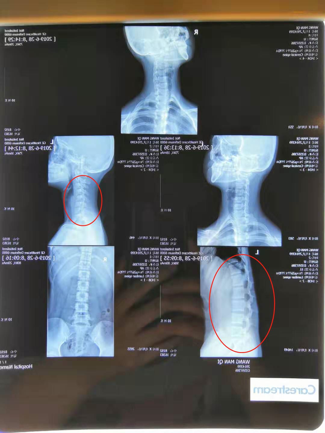 瑜伽九大关节屈伸,瑜伽如何提高身体灵活度