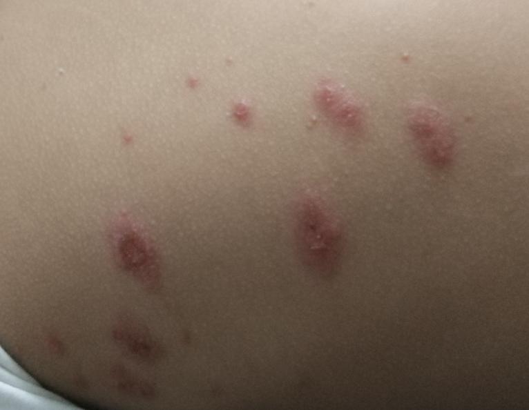 换季了孩子皮肤干燥怎样护理,儿童秋季皮肤干燥发痒怎么办