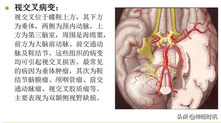 脑神经包含自主神经,脑神经算是传入神经吗
