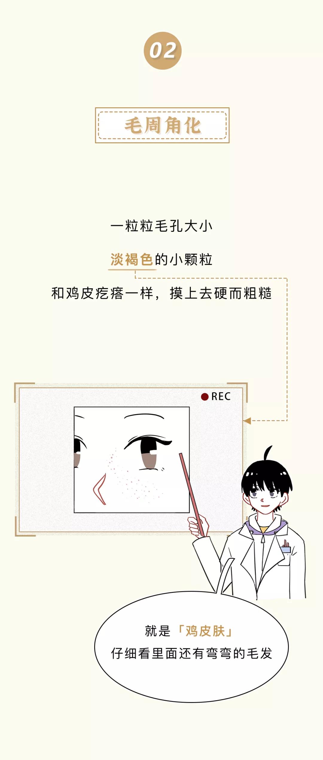 眼睛周围的脂肪粒会传染吗,去眼睛周围脂肪粒最佳方法