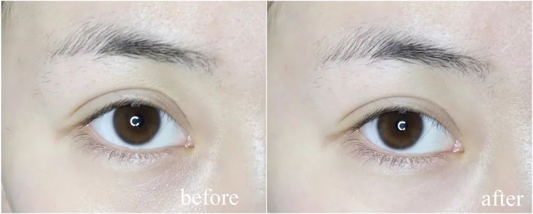 雅萌到底该怎么选,雅萌顶配值得入手吗