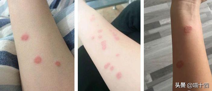 宠物荧光伍德氏灯,猫癣专用伍德氏灯