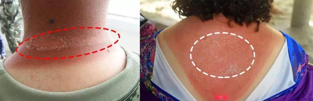 日本防晒衣遮脸防紫外线,日本防晒衣哪种颜色最防晒