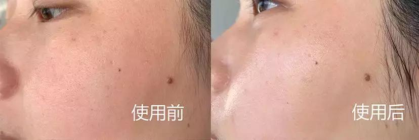 新西兰8分钟面膜真的好吗,新西兰八分钟面膜使用方法