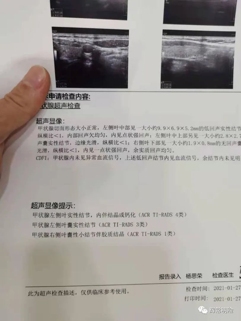 理赔实录|甲状腺癌赔50.91万，免除保险费25.5万，保障继续有效