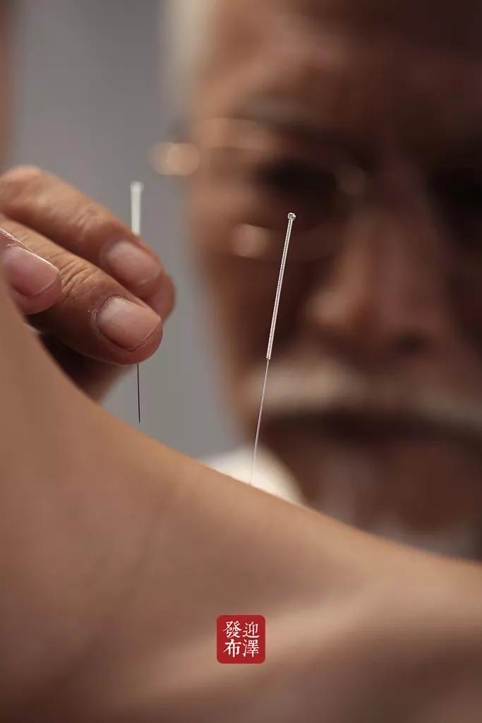 老魏祖传古法针灸,魏氏古法针灸李大成诊所