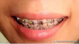 你的牙齿是否符合以上标准呢,你的牙齿够整齐吗
