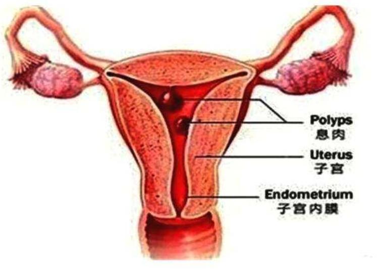 母女双得癌症最新消息,母女一起得癌症