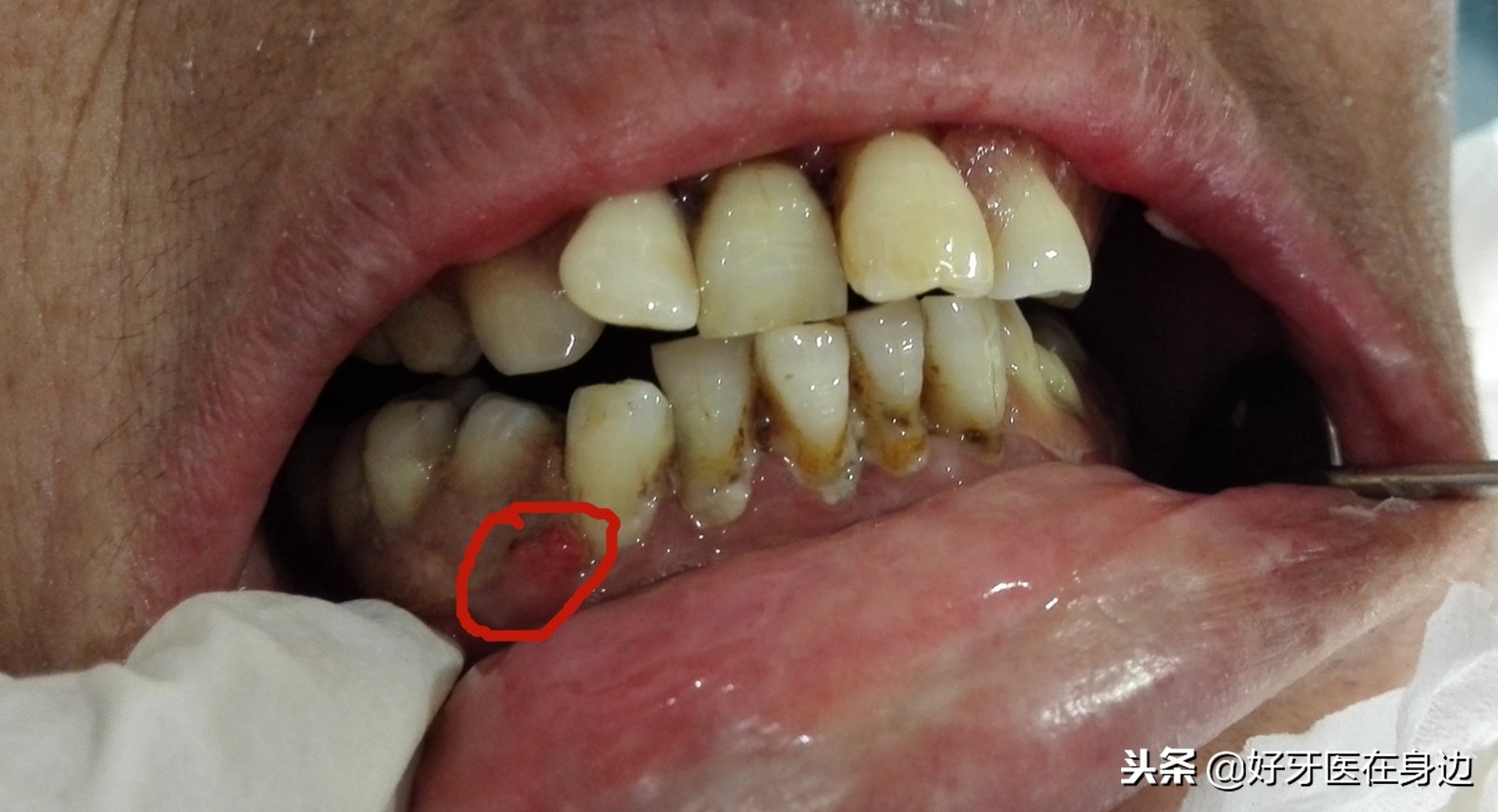 别再这样镶牙啦，孝顺就转给父母看看吧！