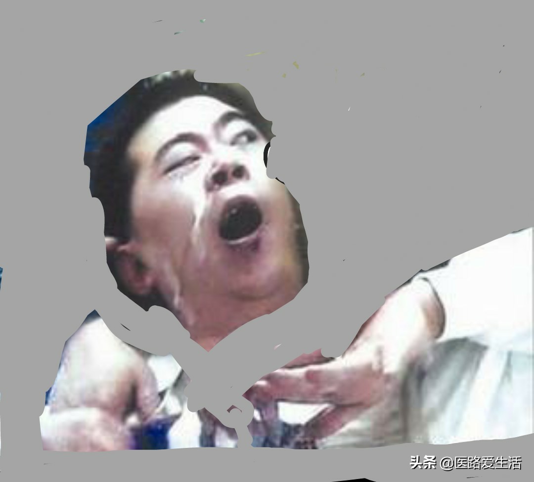 功能性疾病包括哪些,功能性疾病最好的治疗方法