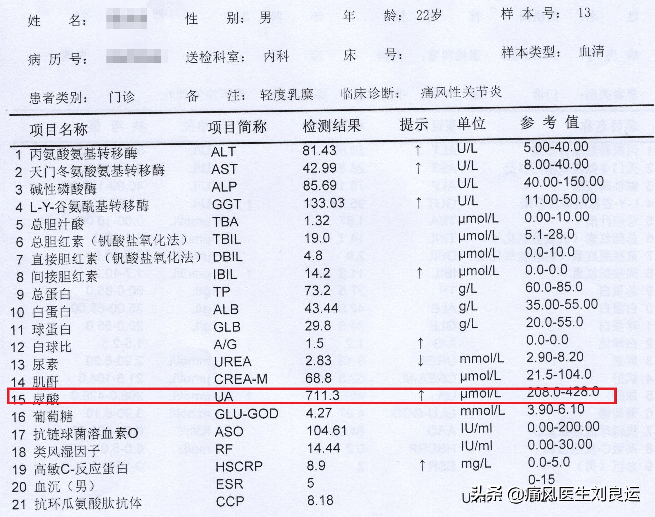 脚很痛不知道是扭伤还是痛风,脚痛不肿怎么判断是不是痛风