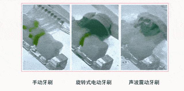 高伟光同款牙刷,高伟光牙刷介绍