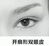 男生割眼皮术后,男性割眼皮后1-7天恢复图