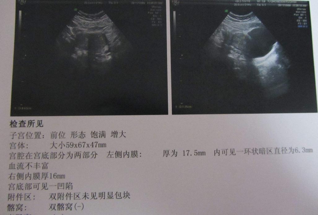 孕妈上怀的肚型和下怀的肚型,孕肚前位和后位的孕肚区别