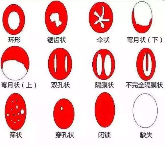 可以泡温泉用的卫生巾,棉条卫生巾可以泡温泉吗