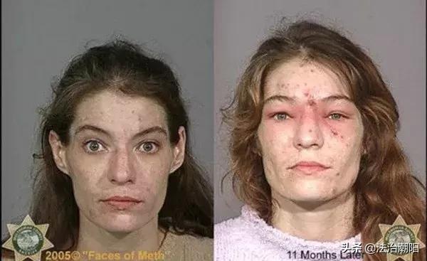 *毒冰**疮、*古麻**痘，拿什么来拯救这张脸？