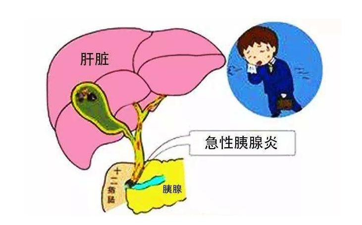 薅保险公司的钱,胰腺疾病保险怎么投保