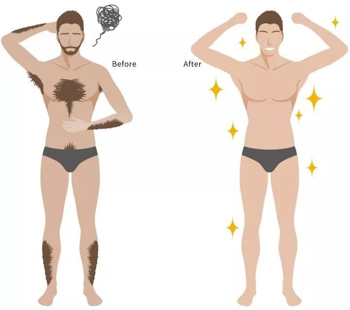 小米剃毛器男士专用,小米除体毛器电动