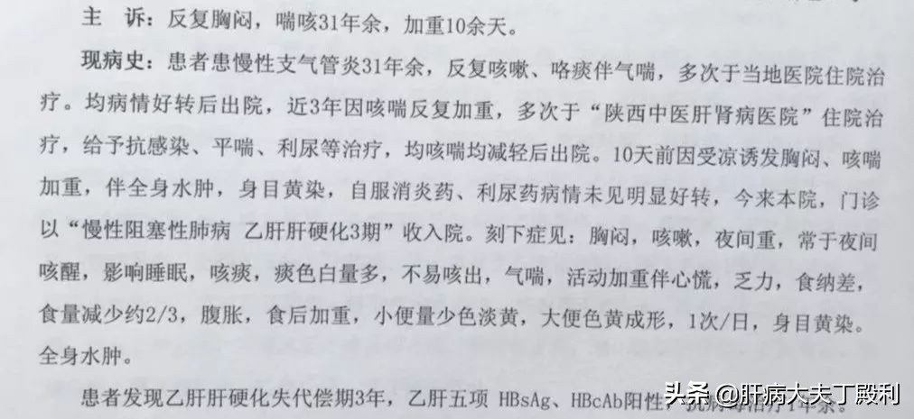 肝硬化慢阻肺,肝硬化导致肝衰竭患者视频