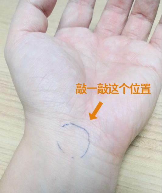 女子出现手麻,拖延1年后就医,手掌这地方已“瘪”掉!年轻人易中招