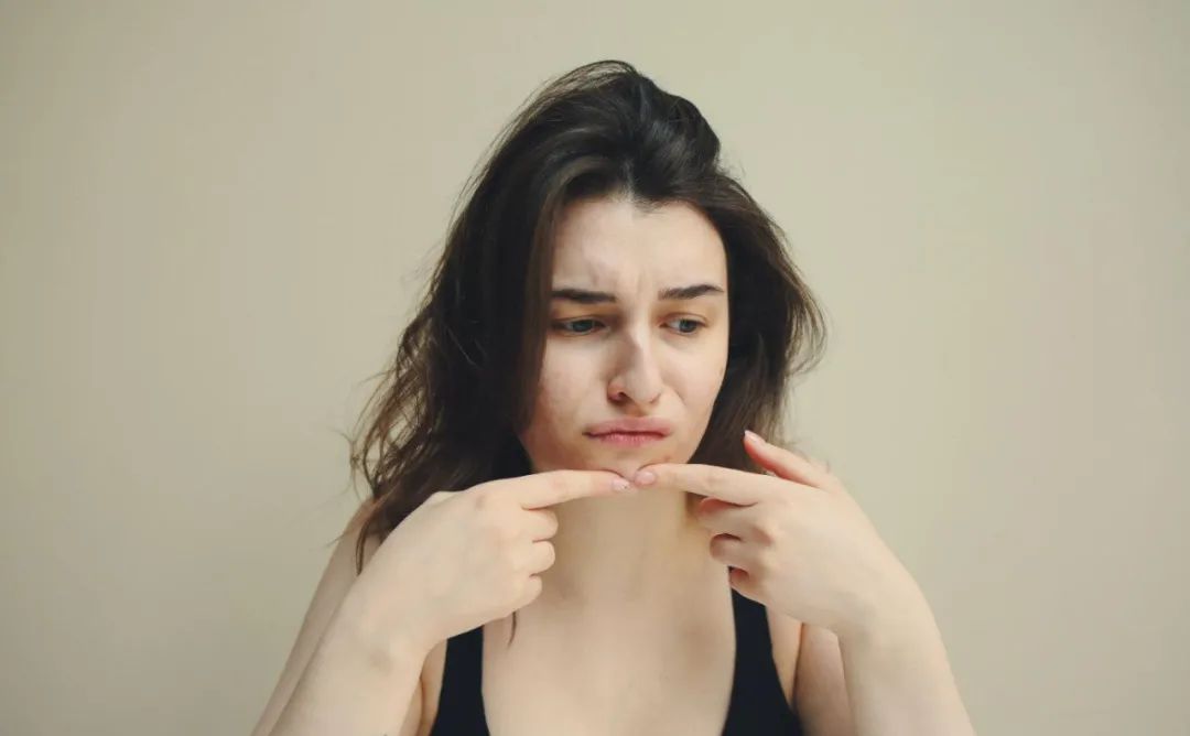 痘痘留下的凸起瘢痕怎么去除,痘痘好了留下肉疙瘩怎么治疗