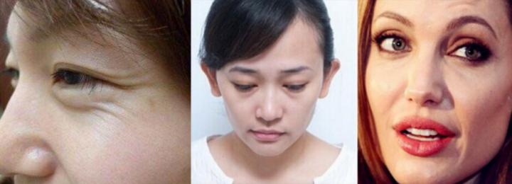 抗衰不再是简单的面部抗衰,抗衰老增加颜值