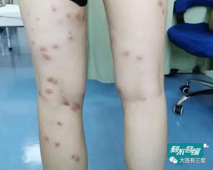 海边游玩遇到的危险,去海边皮肤过敏的原因