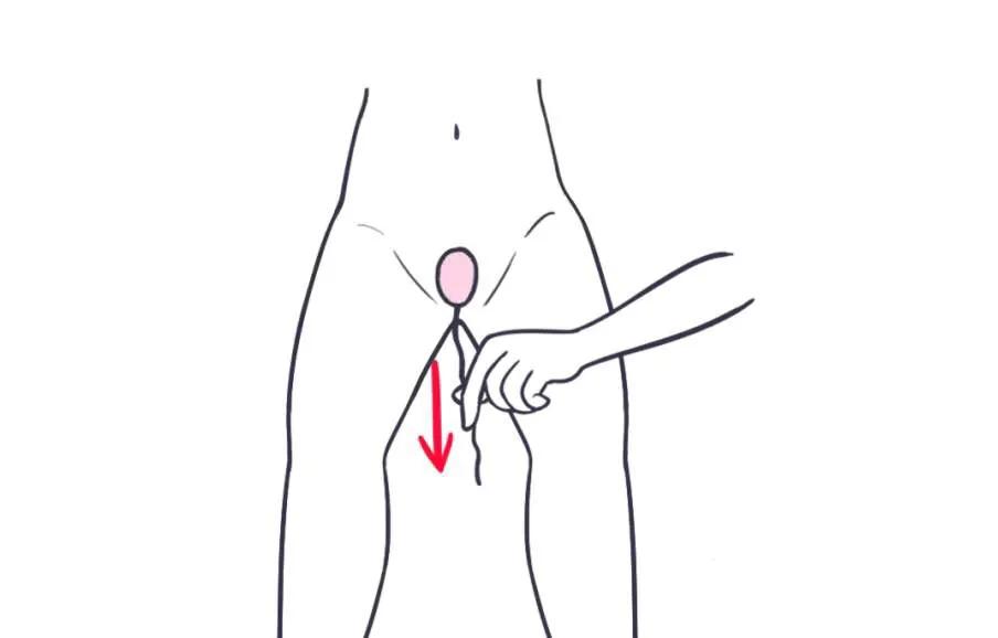 产后哑铃是治疗什么的,哑铃产后修复怎么做