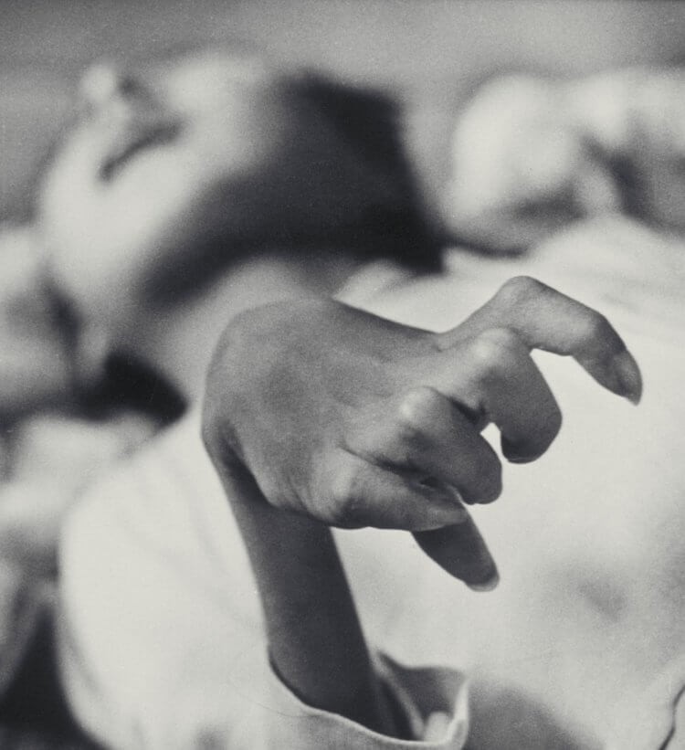 65年前在日本爆发的怪病,1952年日本猫自杀事件