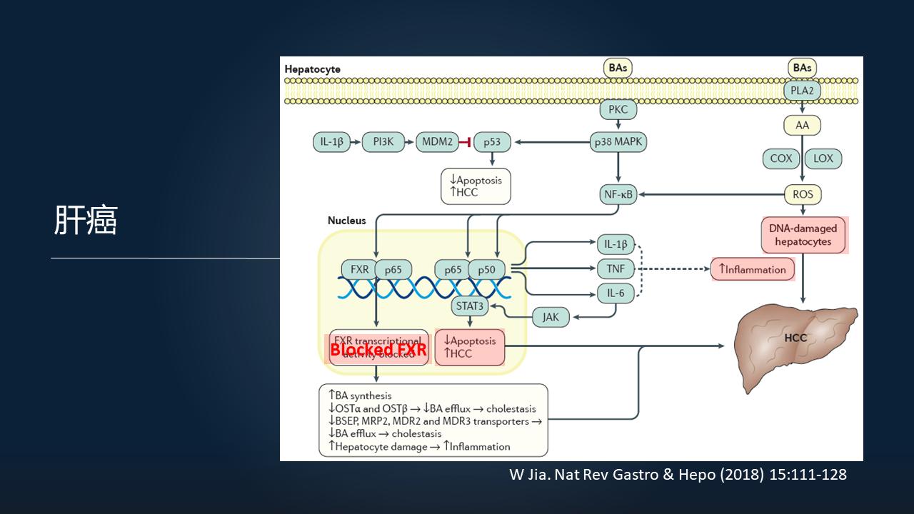 「图文实录」郑晓皎：18分钟详解菌群-胆汁酸与消化系统肿瘤