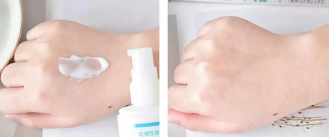 适合夏天油皮痘肌的水乳测评,fresh水乳适合敏感肌油皮