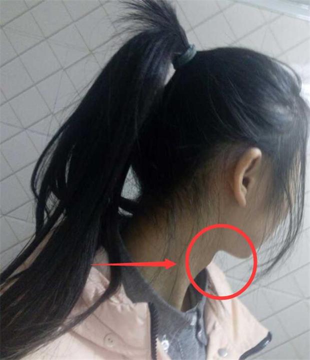 12岁长出喉结胡子正常吗,12岁的孩子长喉结长胡子