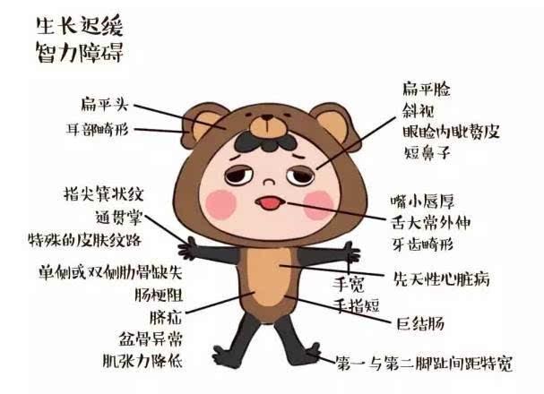 如何知道胎儿是否神经管畸形,如何知道胎儿全前脑畸形的原因