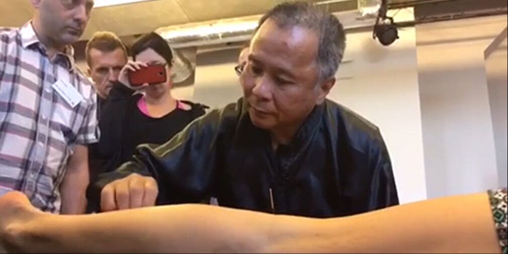 克隆恩氏病中医可以治疗吗,克隆恩氏病治疗费用