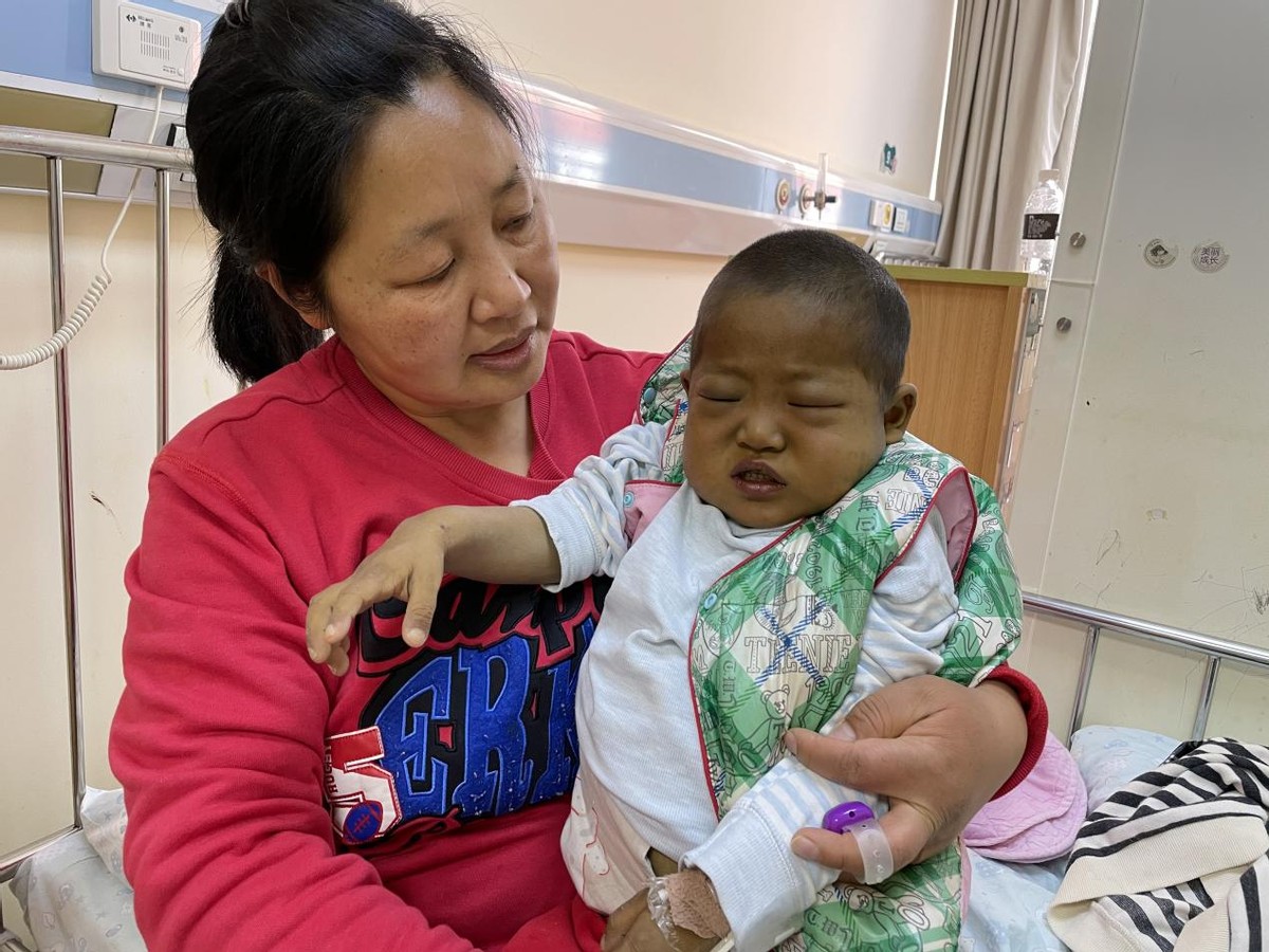 出生一周的婴儿眼睛有点黄,刚出生五天的婴儿眼睛黄