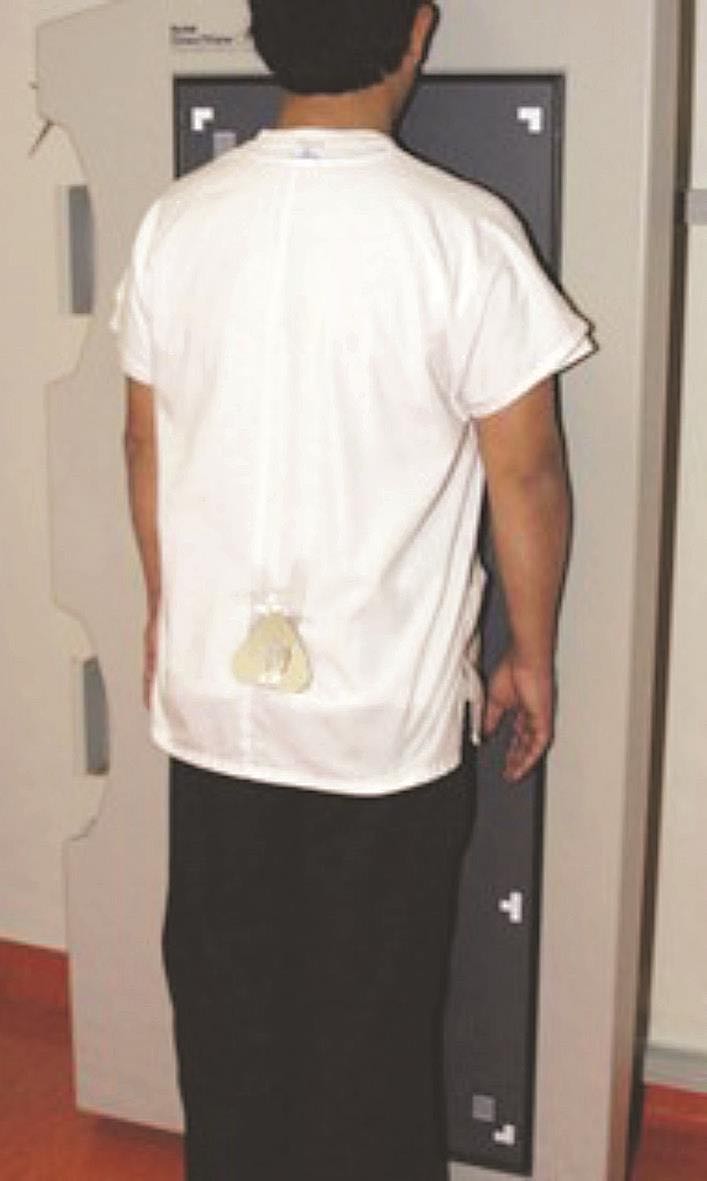 医院x射线危害,如何检测人员受没受x射线辐射